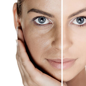 Dull Skin
